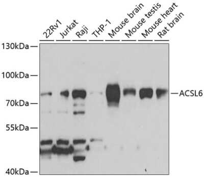 Western Blot: ACSL6 AntibodyBSA Free [NBP2-92246]